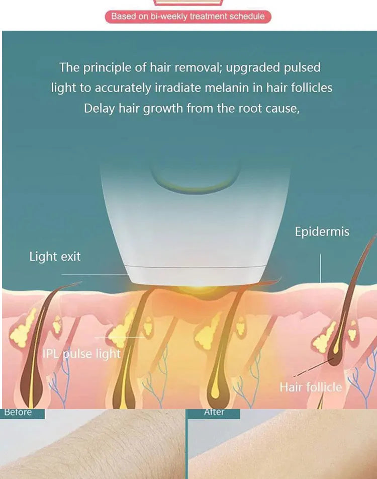 NOVO Body Bikini IPLDepilador Laser Permanente Indolor Para Mulheres Depilação Dispositivos de Uso Doméstico